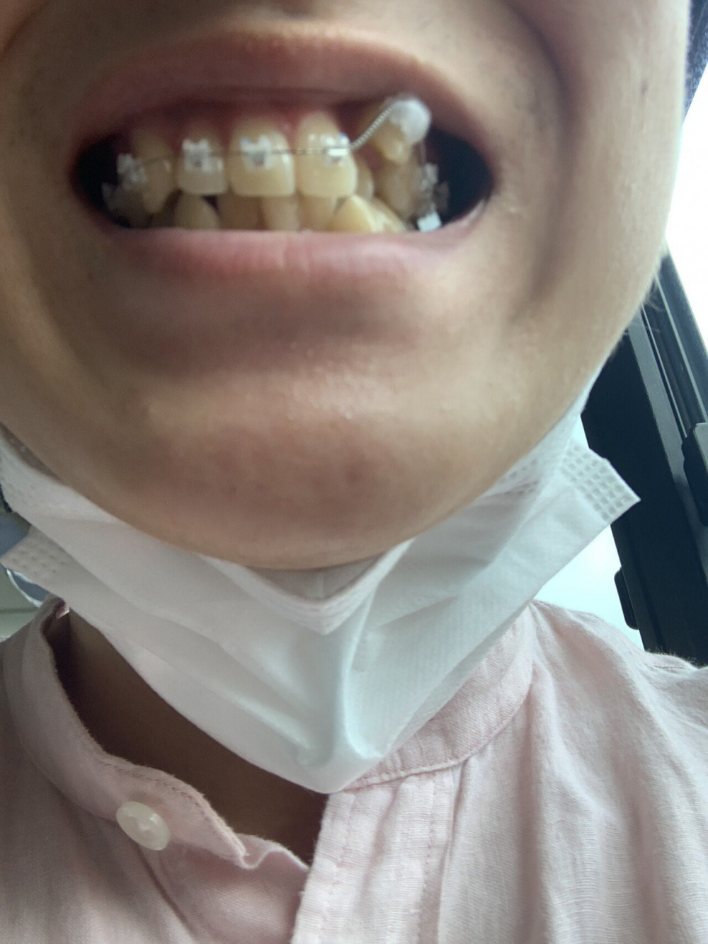 2년 7개월간의 교정이 끝난 펨코인