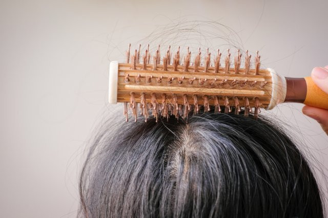 “탈모는 아버지 탓? 모계 유전이 더 강하다”