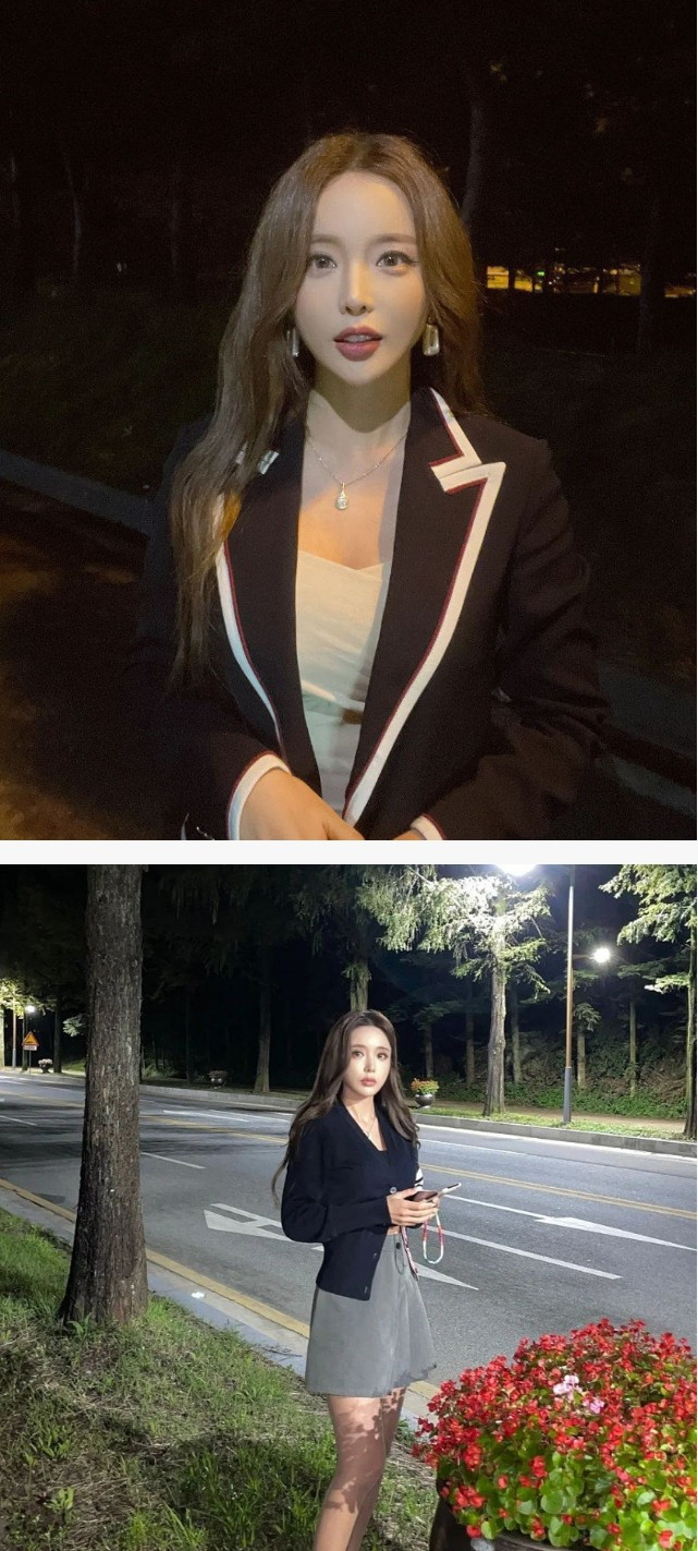 만 38세.. 홍진영 얼굴 근황