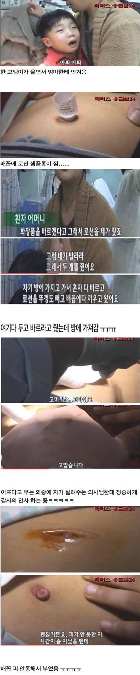 배꼽에 로션통이 낀 아이